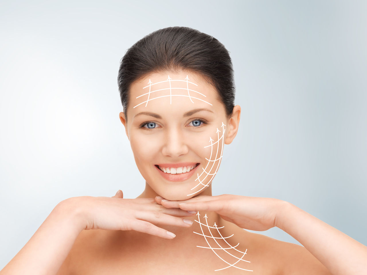 threadlift
